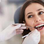 4 Things You Should Know Before Getting A Dental Bonding Treatment