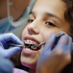 Everything Parents Should Know About Braces For Kids